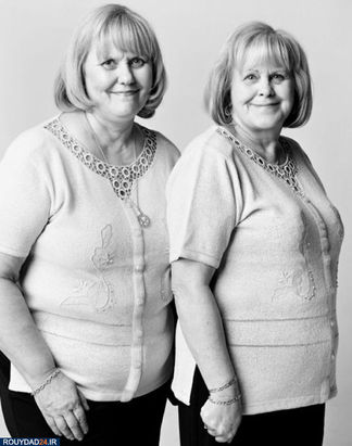 دوقلوهایی که به هم شبیه نیستند