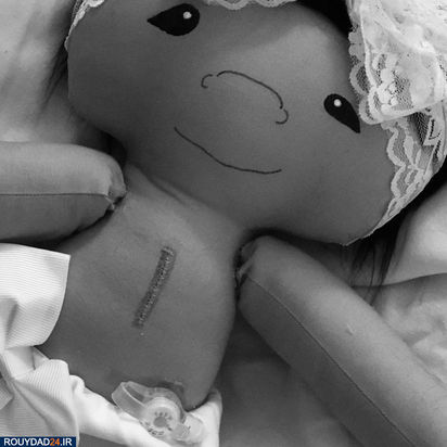 عروسکهای خاص برای کودکان خاص