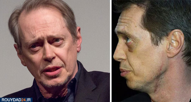 زخمهای سلبها