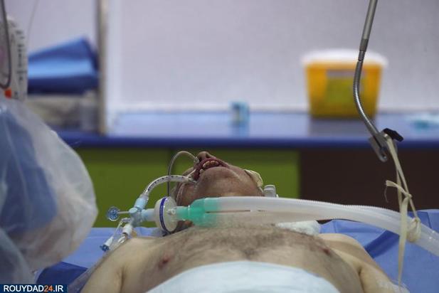 دست و پا زدن کرونایی ها در آی سی یو
