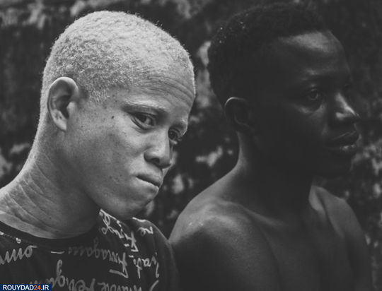 نژادپرستی را متوقف کنید