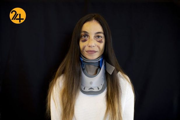 زخمهای انفجار بیروت