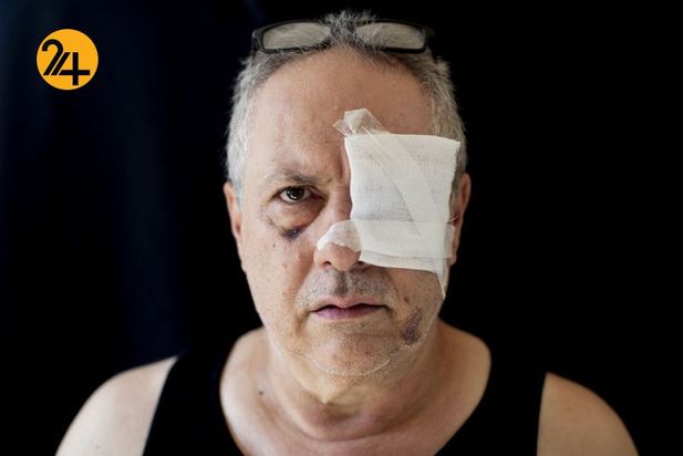 زخمهای انفجار بیروت