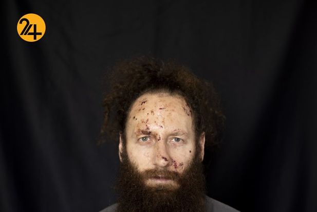 زخمهای انفجار بیروت