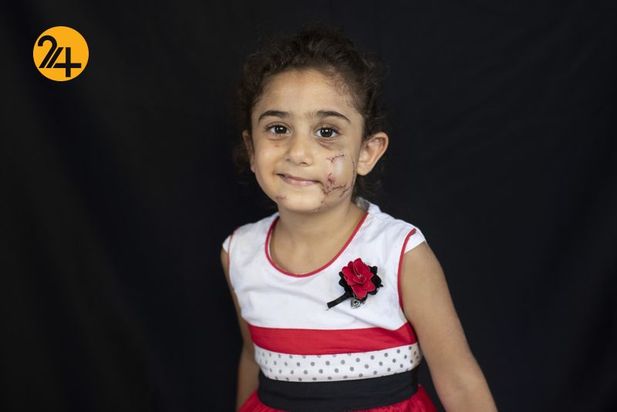 زخمهای انفجار بیروت