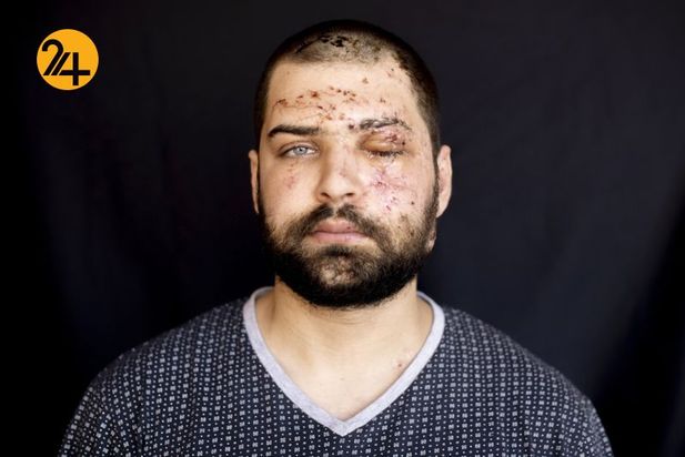 زخمهای انفجار بیروت