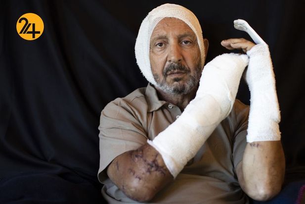 زخمهای انفجار بیروت