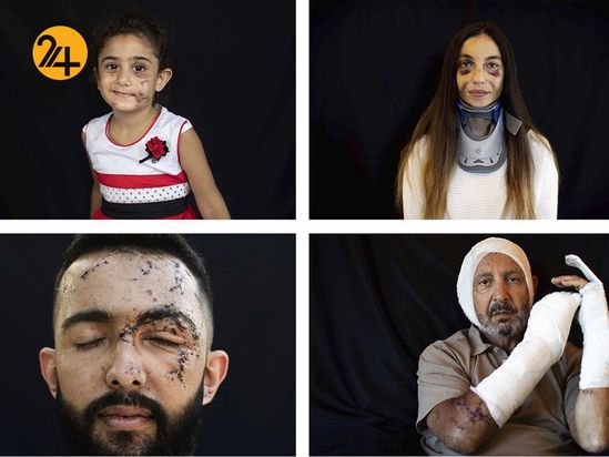 زخمهای انفجار بیروت