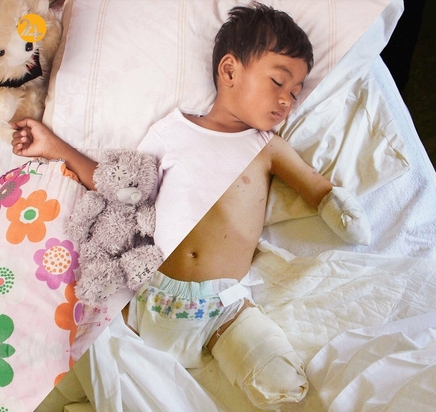 کودکان حقوق مشترک دارند