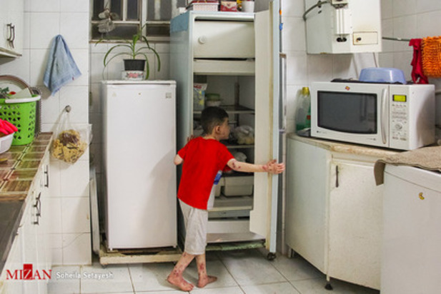 زندگی با زخم پروانه ای