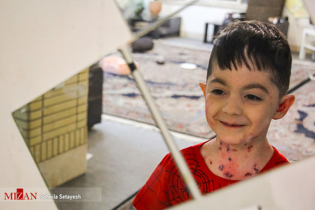 زندگی با زخم پروانه ای