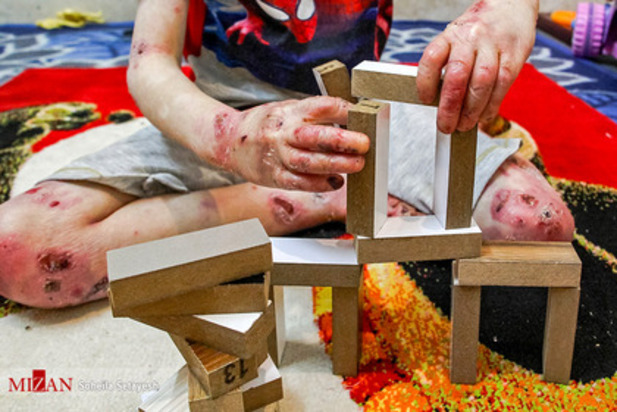 زندگی با زخم پروانه ای