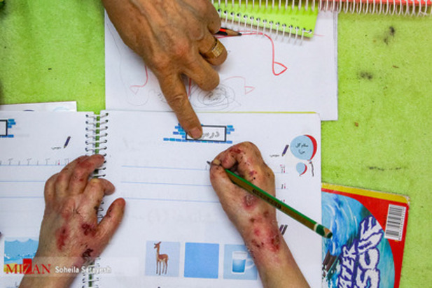 زندگی با زخم پروانه ای