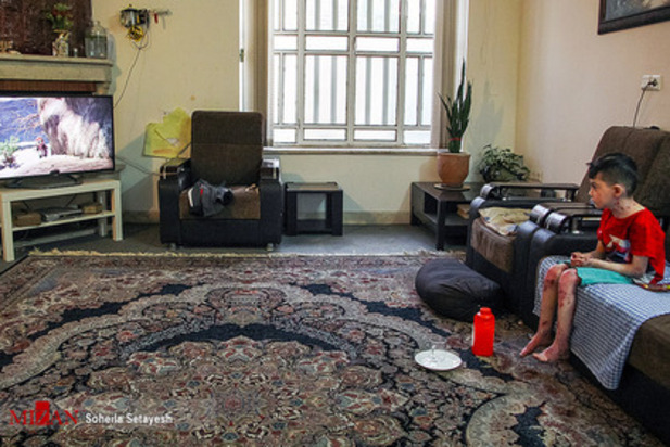 زندگی با زخم پروانه ای