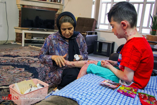 زندگی با زخم پروانه ای