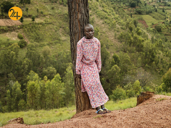 صد تصویر از آفریقایی‌ها و رنج از تبعیض نژادی
