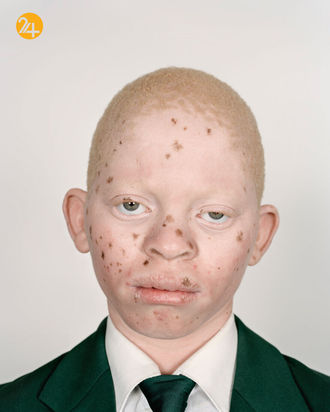 صد تصویر از آفریقایی‌ها و رنج از تبعیض نژادی