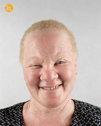 صد تصویر از آفریقایی‌ها و رنج از تبعیض نژادی