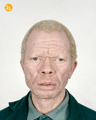 صد تصویر از آفریقایی‌ها و رنج از تبعیض نژادی