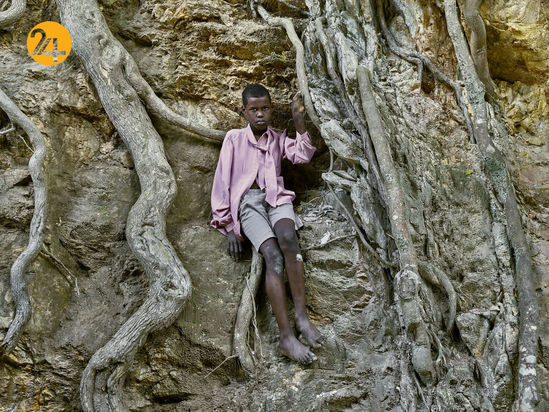 صد تصویر از آفریقایی‌ها و رنج از تبعیض نژادی