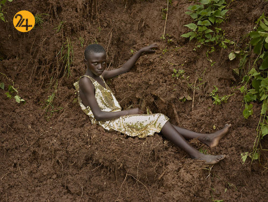 صد تصویر از آفریقایی‌ها و رنج از تبعیض نژادی