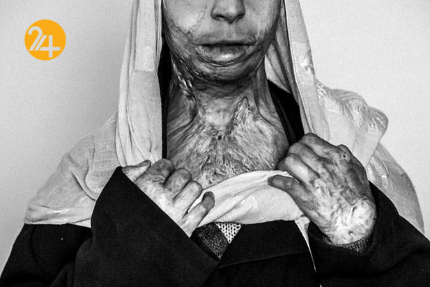 زندگی در جنگ