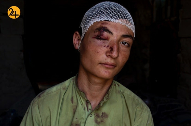 تصاویری غم بار از آوارگان افغان