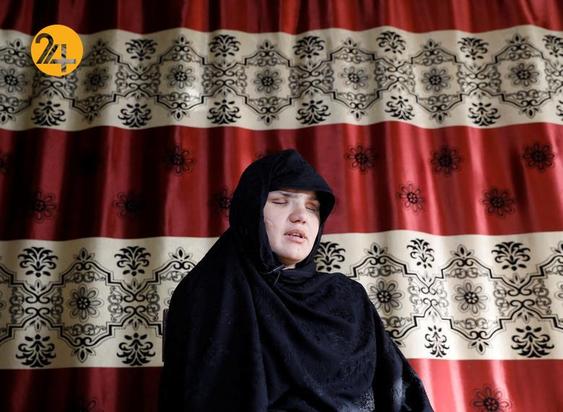 وضعیت زنان افغان