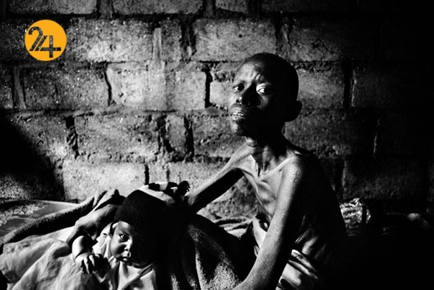 ایدز در زامبیا