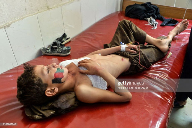 کودکان زخمی و معلول در جنگ افغانستان