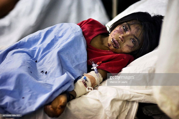 کودکان زخمی و معلول در جنگ افغانستان