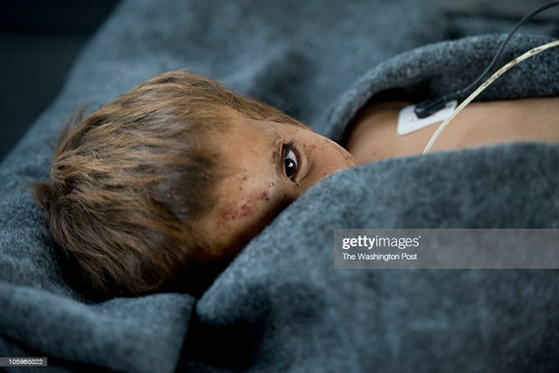 کودکان زخمی و معلول در جنگ افغانستان
