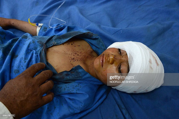 کودکان زخمی و معلول در جنگ افغانستان