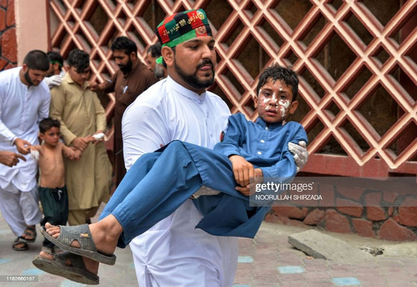 کودکان زخمی و معلول در جنگ افغانستان