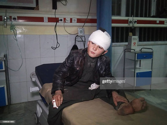 کودکان زخمی و معلول در جنگ افغانستان