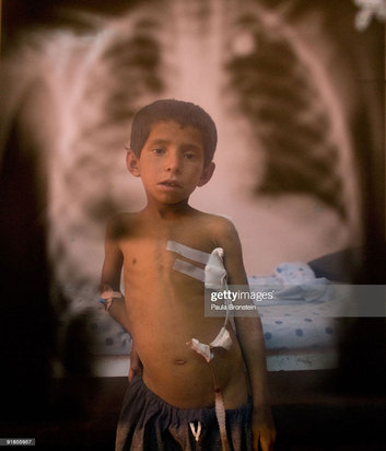 کودکان زخمی و معلول در جنگ افغانستان