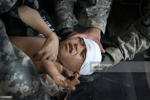 کودکان زخمی و معلول در جنگ افغانستان