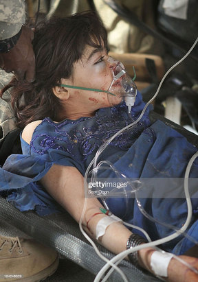 کودکان زخمی و معلول در جنگ افغانستان