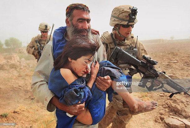 کودکان زخمی و معلول در جنگ افغانستان