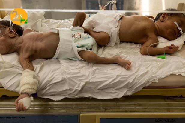 نظام درمان افغانستان در آستانه فروپاشی