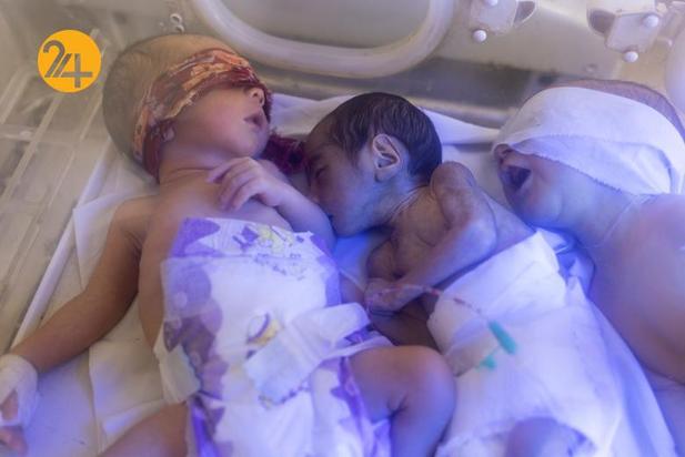 نظام درمان افغانستان در آستانه فروپاشی