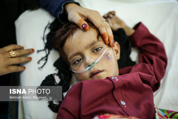 بحران سوء تغذیه کودکان در افغانستان