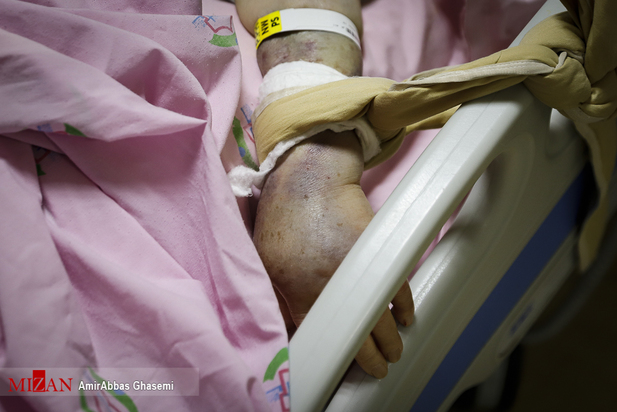 تب داغ امیکرون در بیمارستان‌های تهران