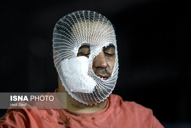 مصدومان چهارشنبه‌سوری سال ۱۴۰۰