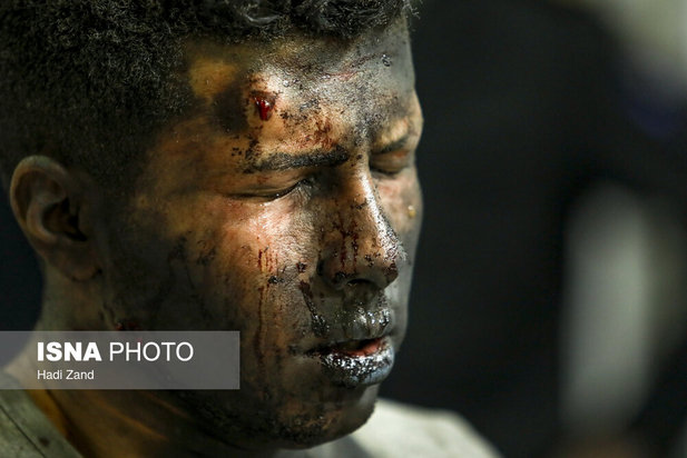 مصدومان چهارشنبه‌سوری سال ۱۴۰۰