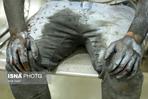 مصدومان چهارشنبه‌سوری سال ۱۴۰۰