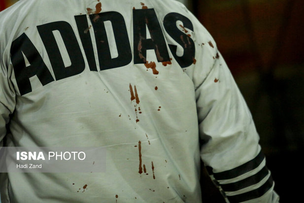 مصدومان چهارشنبه‌سوری سال ۱۴۰۰