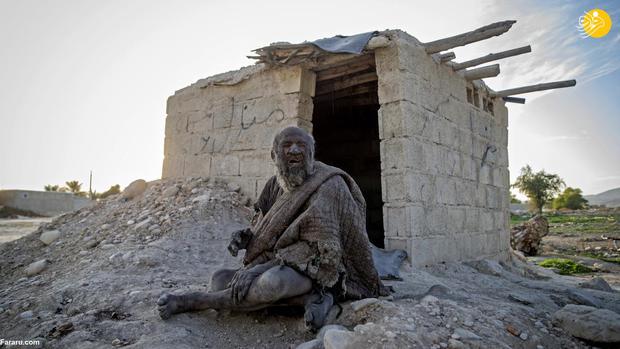 کثیف ترین مرد جهان