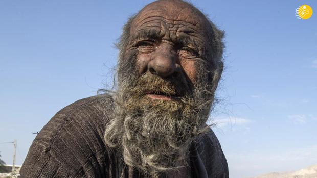 کثیف ترین مرد جهان