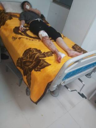 تصاویری دردناک از مجروحان حمله به سالن ورزشی در لامرد